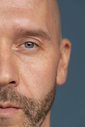 antiaging-beauty-treatment